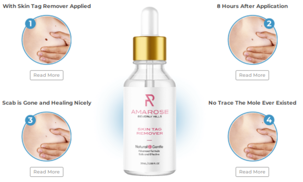 4 steps of using Amarose Skin Tag Remover